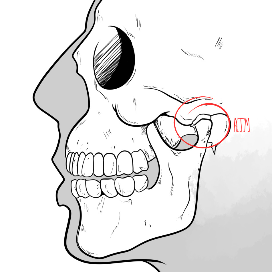 Você tem #bruxismo ? #dor na #mandibula ? Faça esse #exercicios para m